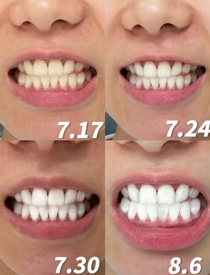 1695730867951039.png 59979b8457a62ead76d51bdc421f2a5.png