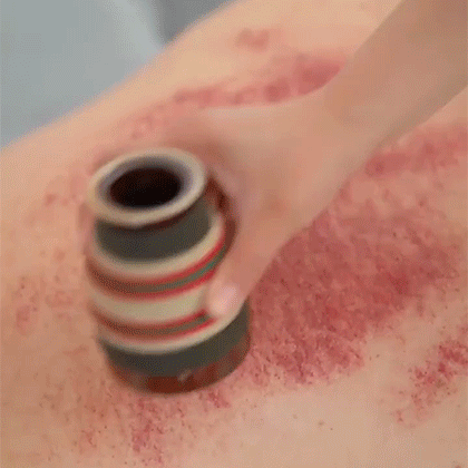 1703218408219693.gif 2.gif